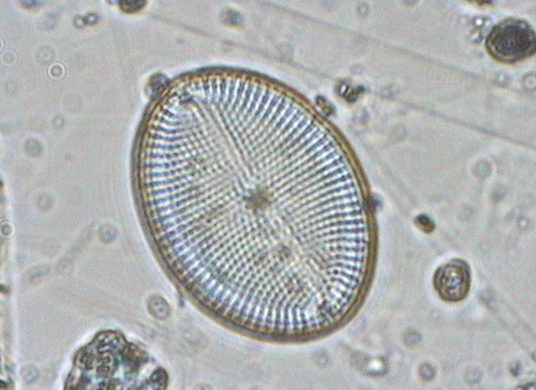 Dictyocha speculum